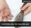 Cách khắc phục tóc rụng hiệu quả 