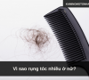 Vì sao rụng tóc nhiều ở nữ?