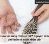 Vì sao tóc rụng nhiều ở nữ? Nguyên nhân phổ biến và cách nhận biết