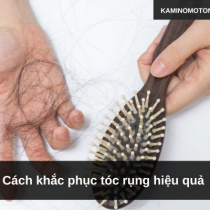 Cách khắc phục tóc rụng hiệu quả 