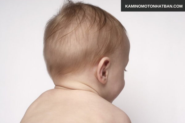 Các kiểu rụng tóc thường gặp ở trẻ 1 tháng tuổi