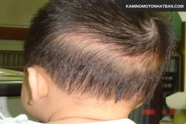 Cách chăm sóc giúp hạn chế rụng tóc ở trẻ sơ sinh 1 tháng tuổi