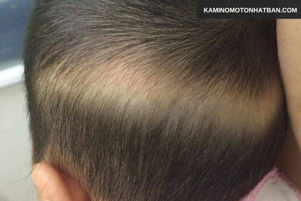 Chu kỳ phát triển tự nhiên của tóc