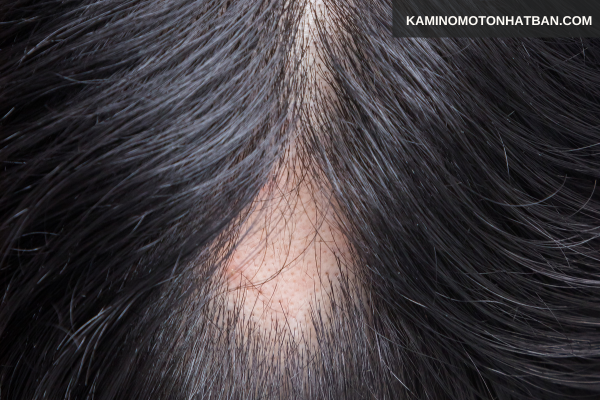 Dấu hiệu nhận biết