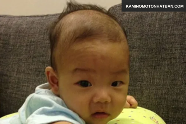 Khi nào rụng tóc ở trẻ 1 tháng tuổi cần đi khám?