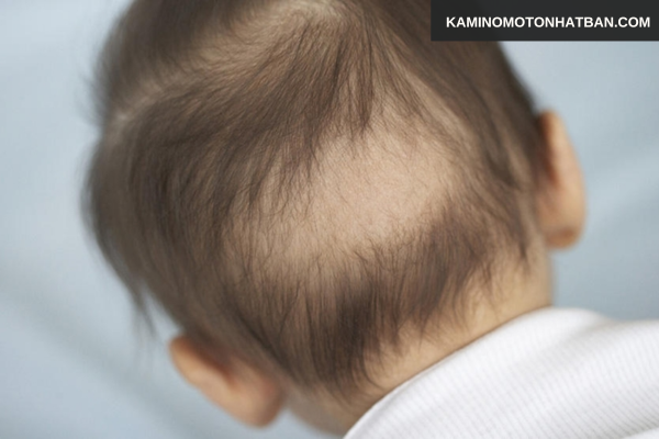 Ma sát vùng đầu