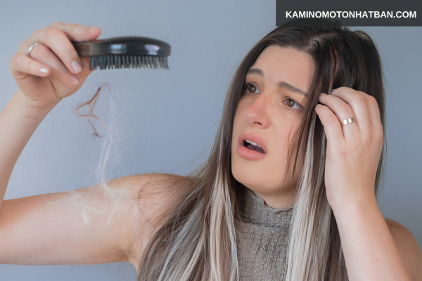 Nguyên nhân gây rụng tóc nhiều