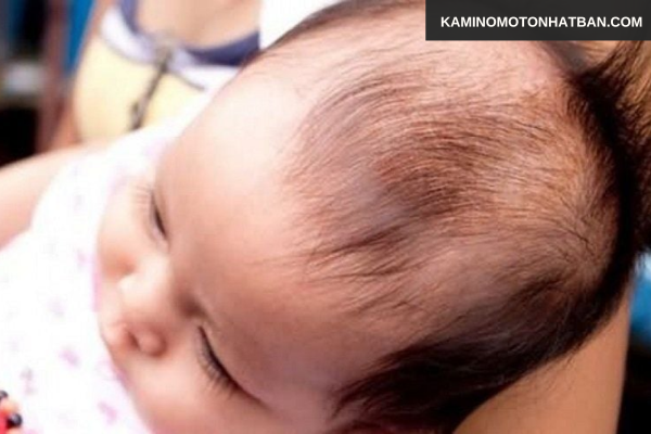 Rụng tóc ở trẻ sơ sinh 1 tháng tuổi có bình thường không?