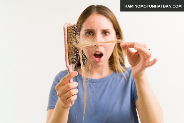 Tóc rụng nhiều là gì?