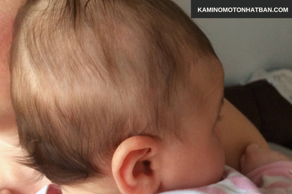 Thay đổi hormone sau sinh