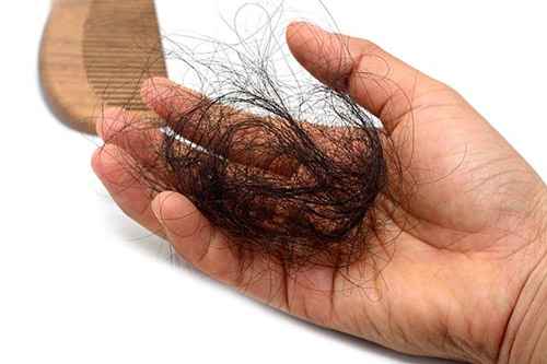 Nguyên nhân của bệnh rụng tóc